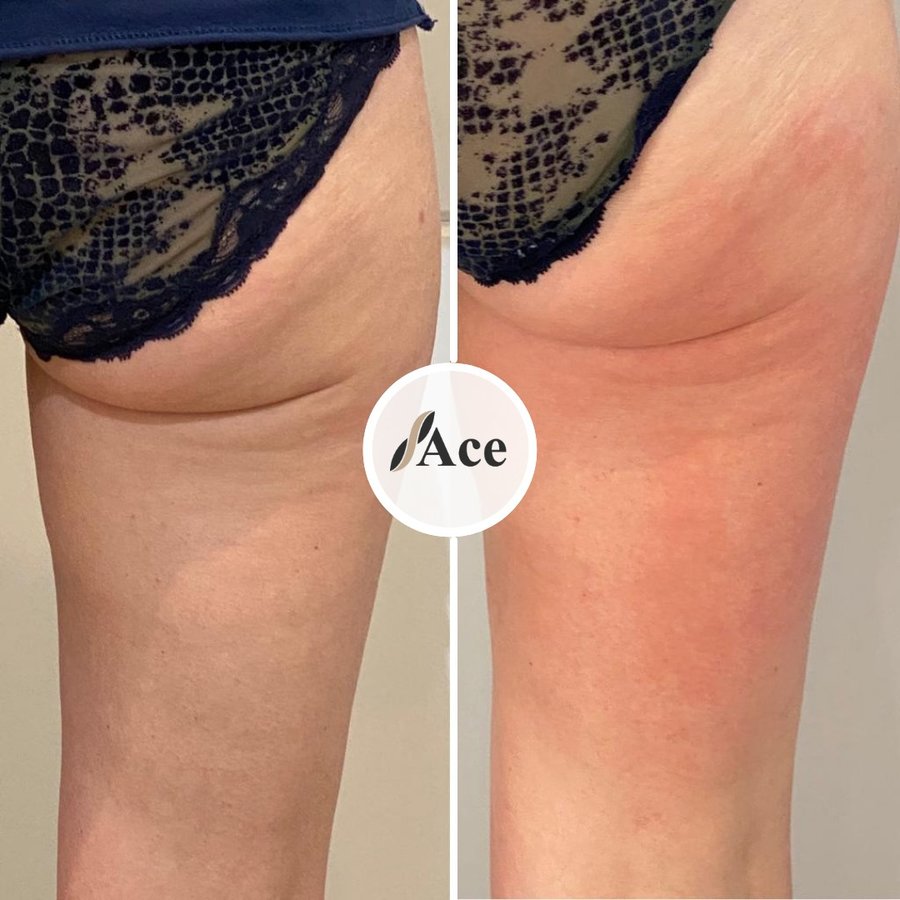 Ace Aesthetics - Ace Aesthetics